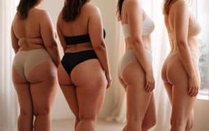 Ist Cellulite normal?